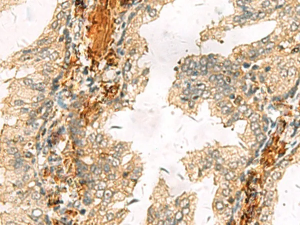 ACTC1 Polyclonal Antibody - image 1