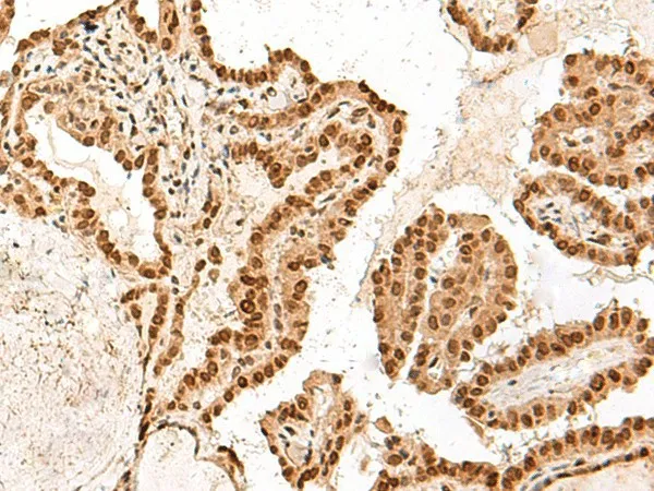 ARMC8 Polyclonal Antibody - image 1