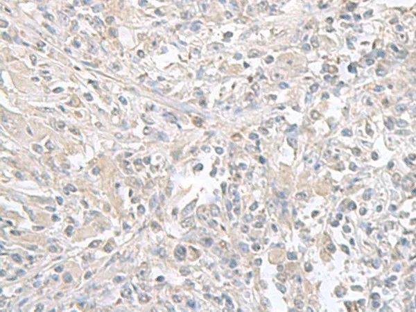FXYD6 Polyclonal Antibody - image 1