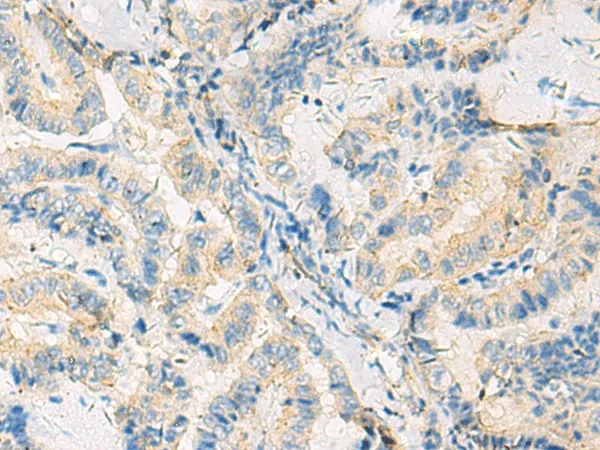 SYNGR1 Polyclonal Antibody - image 1