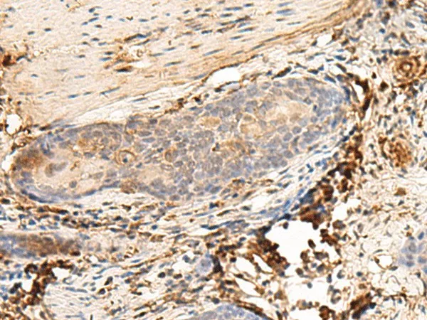 HLA-DQB1 Polyclonal Antibody - image 1