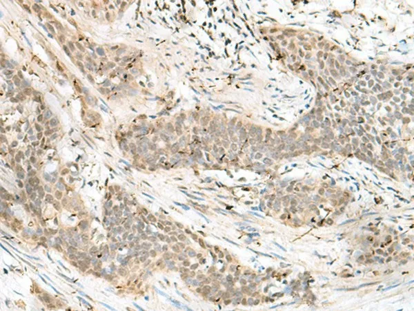 LIG4 Polyclonal Antibody - image 1