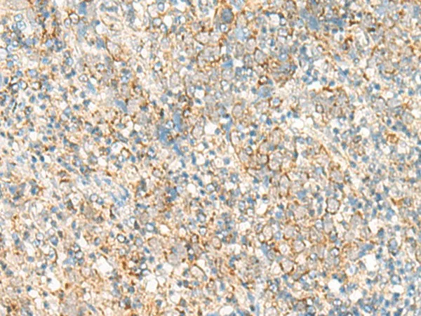 PSD4 Polyclonal Antibody - image 1