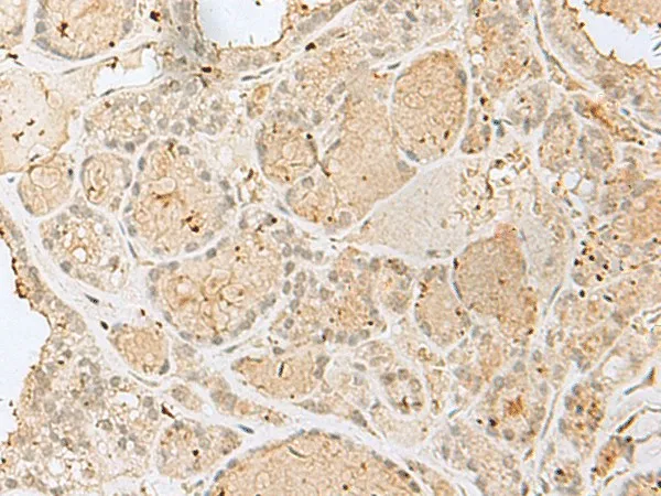 GOLGA7 Polyclonal Antibody - image 1