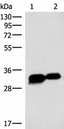 HCCS Polyclonal Antibody - image 1