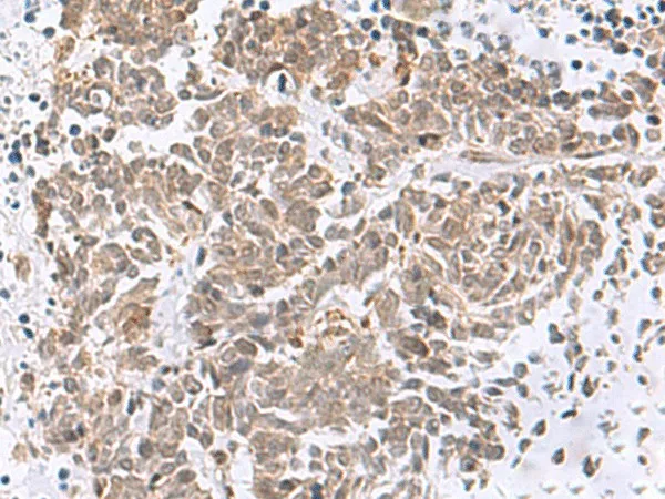 RBFOX2 Polyclonal Antibody - image 1