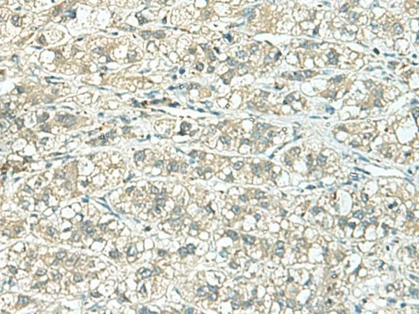 TENT5C Polyclonal Antibody - image 1