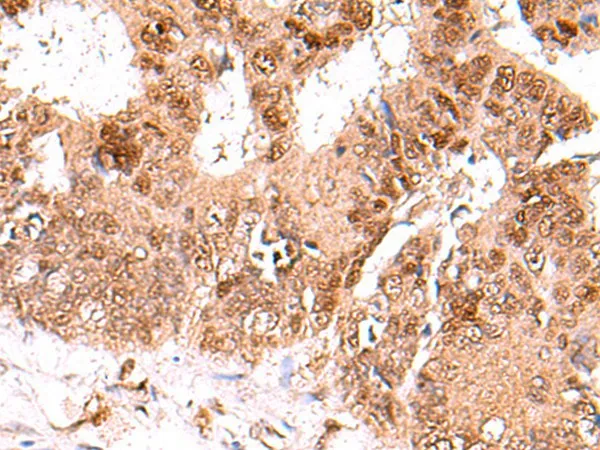 FDPS Polyclonal Antibody - image 1