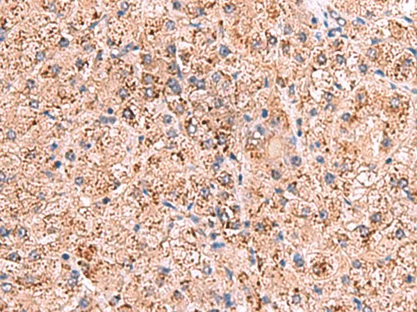 OSBPL2 Polyclonal Antibody - image 1