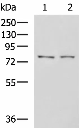 GPCPD1 Polyclonal Antibody - image 1