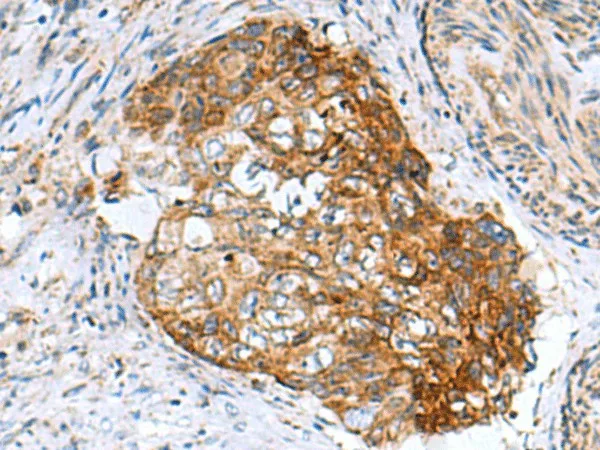 AP1S3 Polyclonal Antibody - image 1