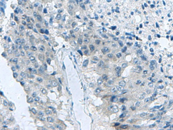 MED31 Polyclonal Antibody - image 1