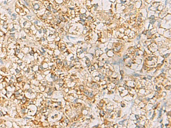 HLA-DQB2 Polyclonal Antibody - image 1