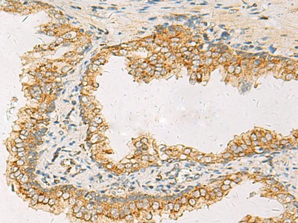 SUSD3 Polyclonal Antibody - image 1