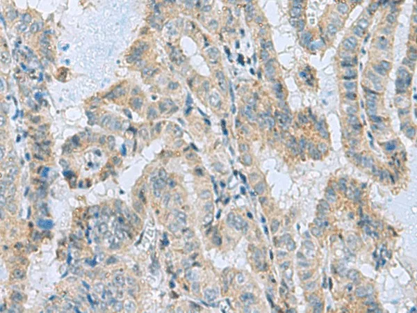 MGME1 Polyclonal Antibody - image 1