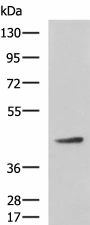 ARPC1B Polyclonal Antibody - image 1