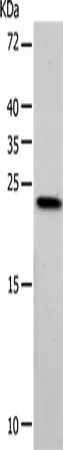 VSNL1 Polyclonal Antibody - image 1