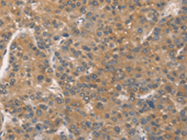 ZADH2 Polyclonal Antibody - image 1