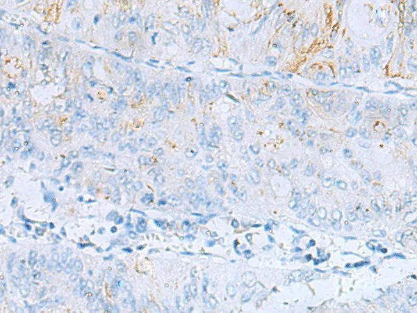 ERBB2 Polyclonal Antibody - image 1