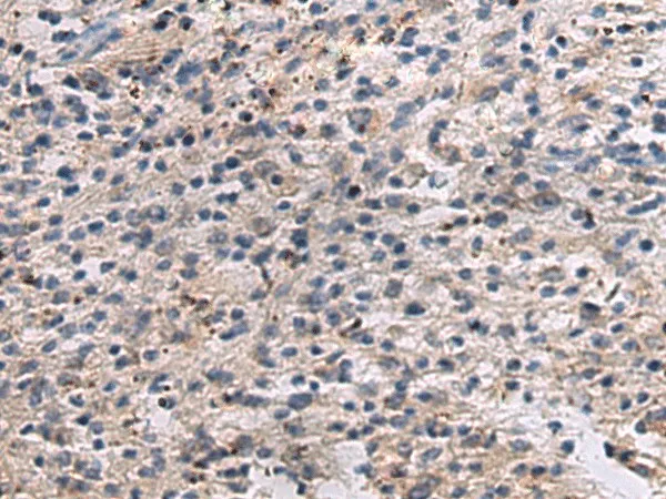 ANGPTL2 Polyclonal Antibody - image 1