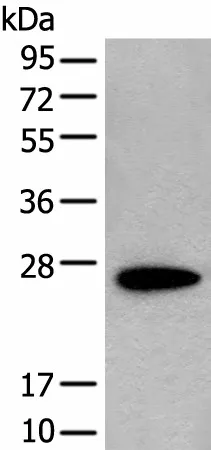 CD63 Polyclonal Antibody - image 1
