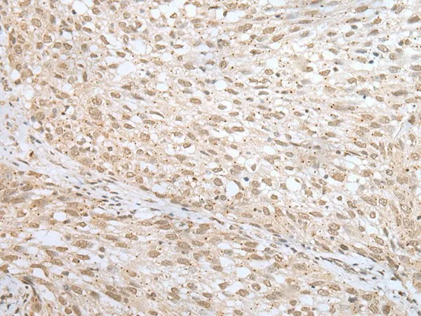 MORF4L1 Polyclonal Antibody - image 1