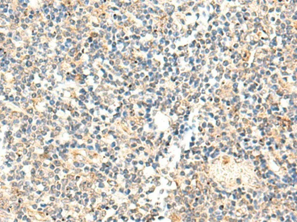 ADAMTS2 Polyclonal Antibody - image 1