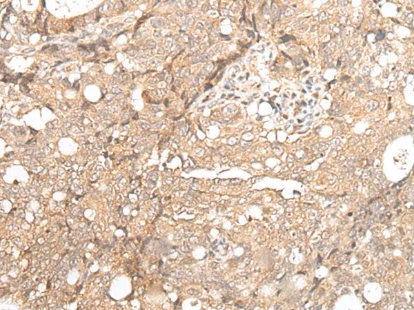 FOXO4 Polyclonal Antibody - image 1