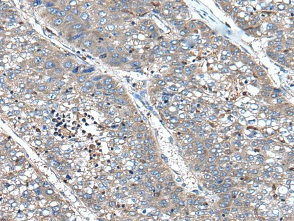XIRP1 Polyclonal Antibody - image 1