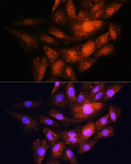 YWHAE Polyclonal Antibody - image 1