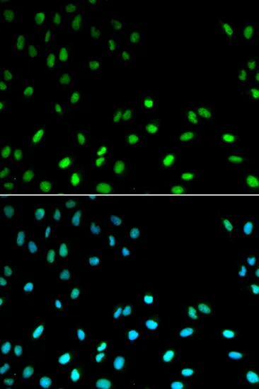 RFC1 Polyclonal Antibody - image 1