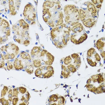 HDAC6 Polyclonal Antibody - image 1