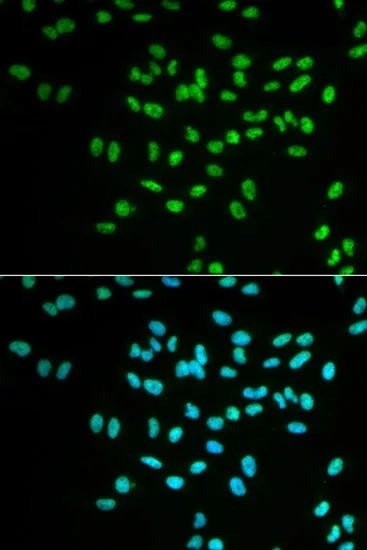 FANCD2 Polyclonal Antibody - image 1