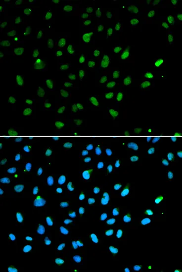(KO Validated) SMARCA4 Polyclonal Antibody - image 1