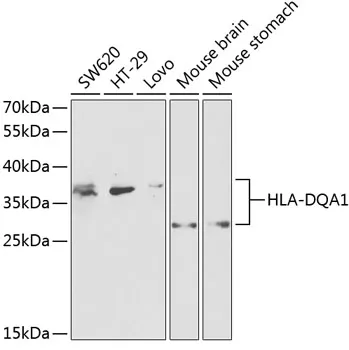 HLA-DQA1 Polyclonal Antibody - image 1