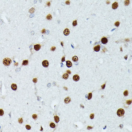 MEF2C Polyclonal Antibody - image 1