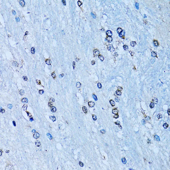 NFkB p100 / p52 Polyclonal Antibody - image 1