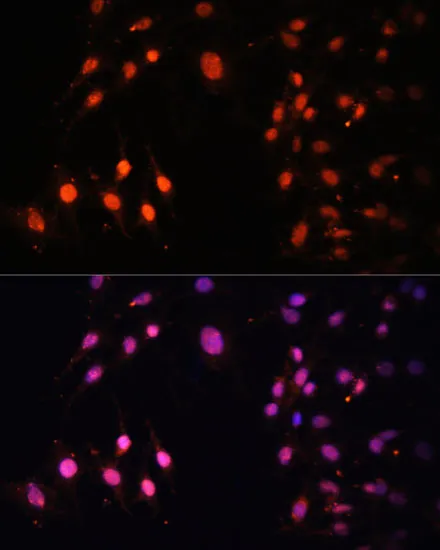 SETD2 Polyclonal Antibody - image 1