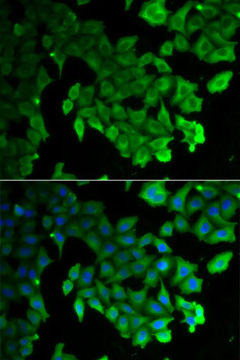 LC3A/LC3B Polyclonal Antibody - image 1