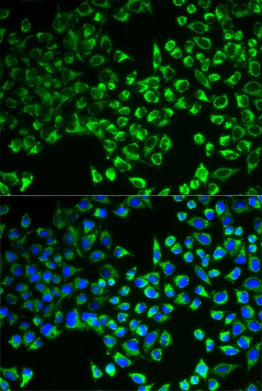 CS Polyclonal Antibody - image 1