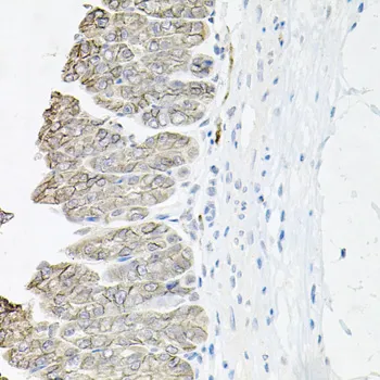 ATP1B1 Polyclonal Antibody - image 1