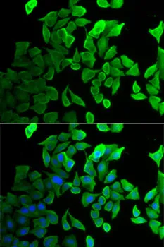 SEPT2 Polyclonal Antibody - image 1