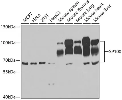 SP100 Polyclonal Antibody - image 1