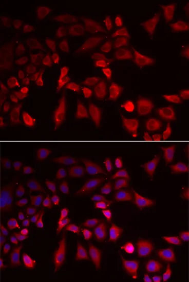 PYGL Polyclonal Antibody - image 1