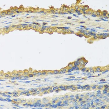 TSHB Polyclonal Antibody - image 1
