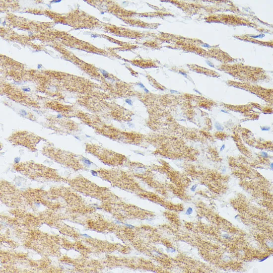 MAP2K5 Polyclonal Antibody - image 1