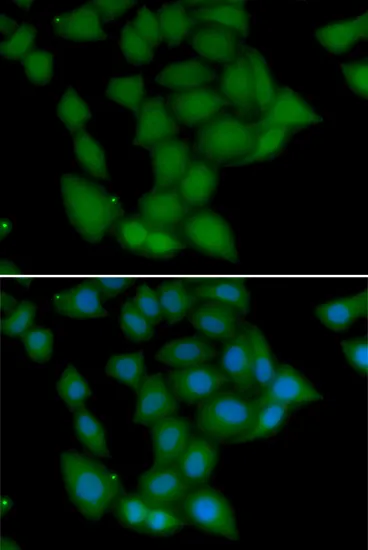 CAMK1 Polyclonal Antibody - image 1