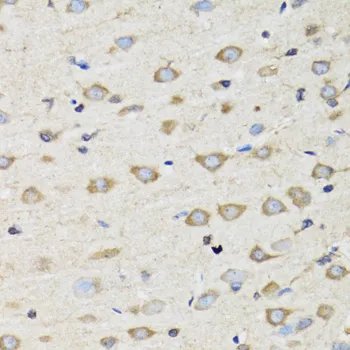 CLIC4 Polyclonal Antibody - image 1