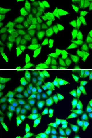 HDAC5 Polyclonal Antibody - image 1