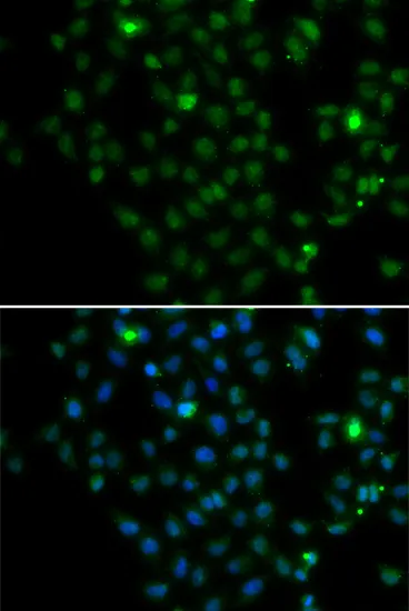 LMO4 Polyclonal Antibody - image 1